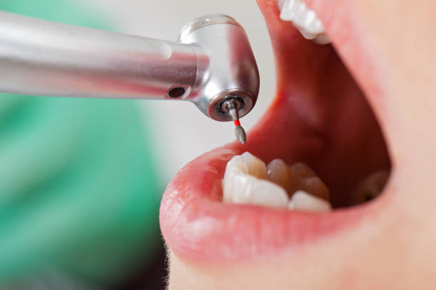 Best Emergency Gum Pain Relief  in Windham, OH